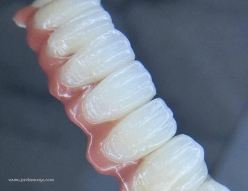 Smile Maker Dental lab  مختبر سمايل ميكر